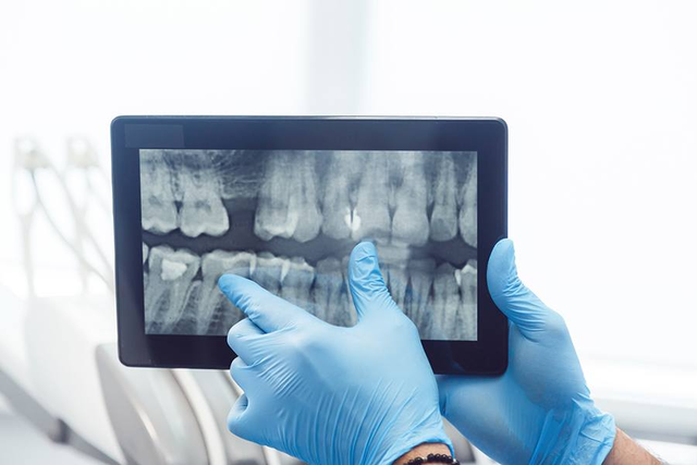 digital radiographs in york