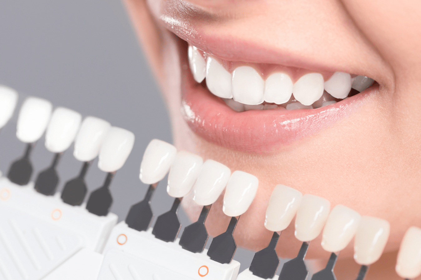 https://www.caledoniacrosstowndental.ca/composite-vs-porcelain-veneers-which-is-better/ https://www.caledoniacrosstowndental.ca/wp-content/uploads/2021/04/composite-vs-porcelain-veneers-which-is-better-1351x900.png composite vs porcelain veneers which is better https://www.caledoniacrosstowndental.ca/wp-content/uploads/2021/04/composite-vs-porcelain-veneers-which-is-better.png composite vs porcelain veneers which is better