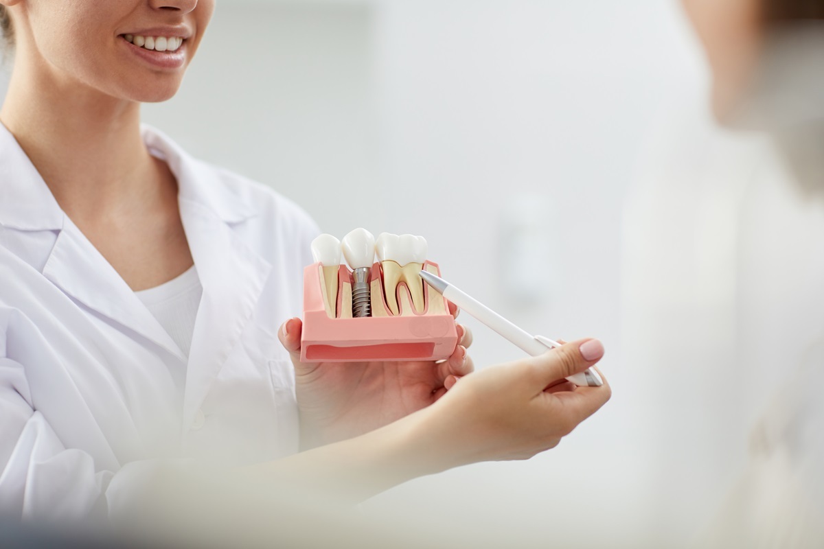 dental implants and severe bone loss explained