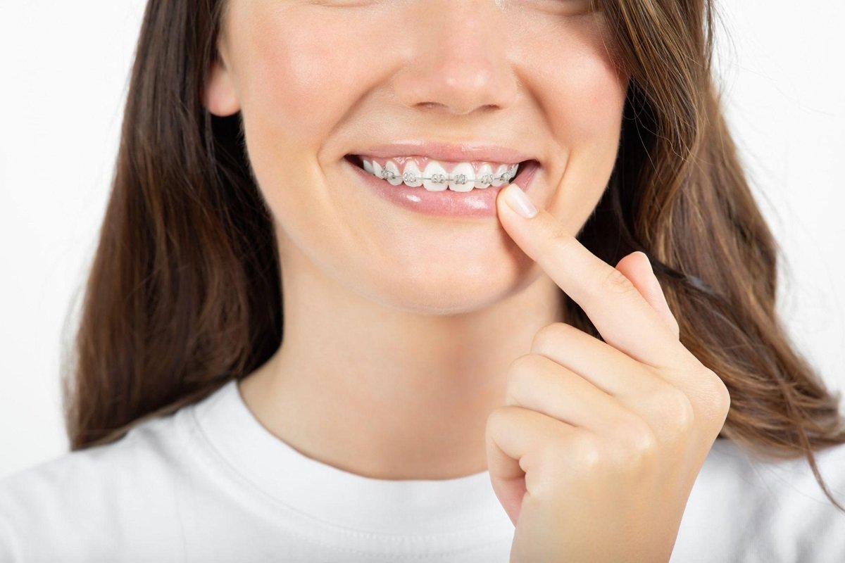 how long does it take to pull down an impacted tooth with braces