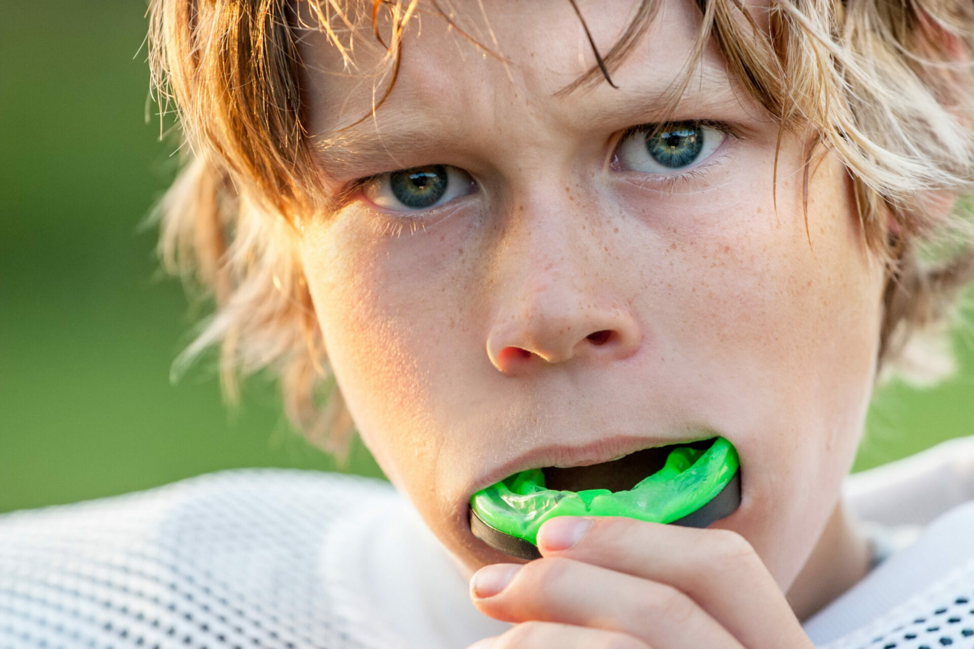How Mouth Guards Help Prevent Sports-Related Dental Injuries